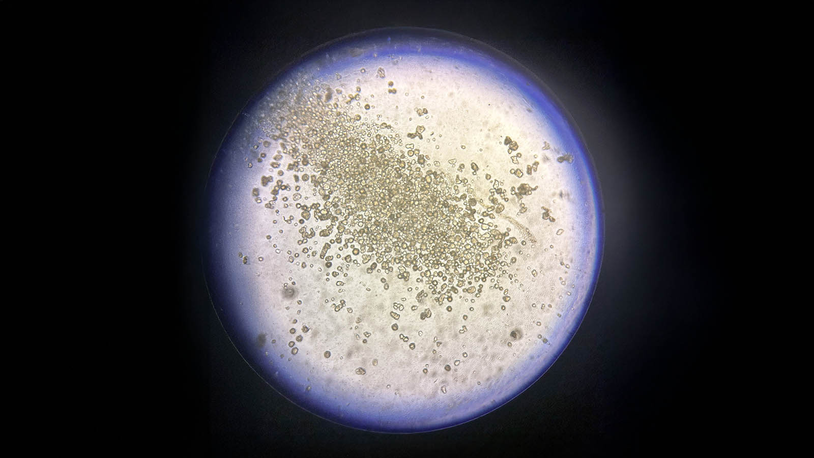 cell cultures in dish